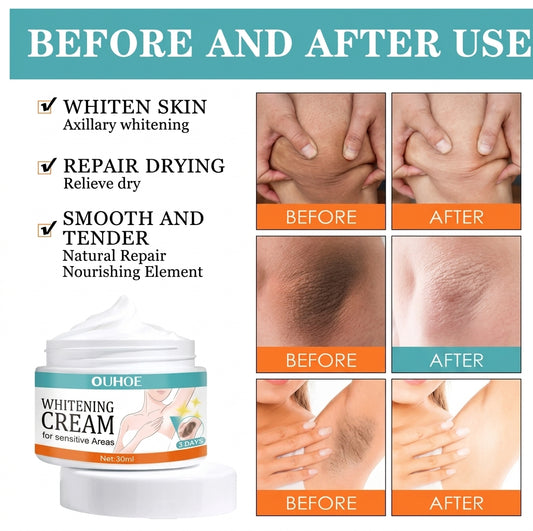 Intimate Area Skin Brightening Cream - Dark Spot & Underarm Repair Cream (30ml)