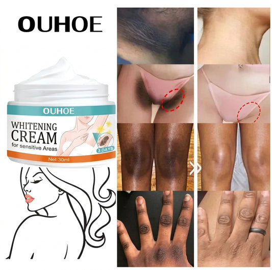Intimate Area Skin Brightening Cream - Dark Spot & Underarm Repair Cream (30ml)